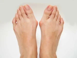 Bunion Pain vs. Other Foot Pain: How to Tell the Difference