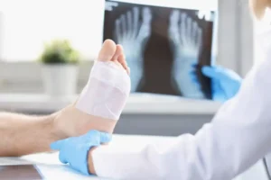 Don't Wait: Why Early Foot Pain Treatment Matters