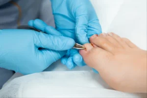 Painful Ingrown Toenails? Here’s What Your Podiatrist Wants You to Know
